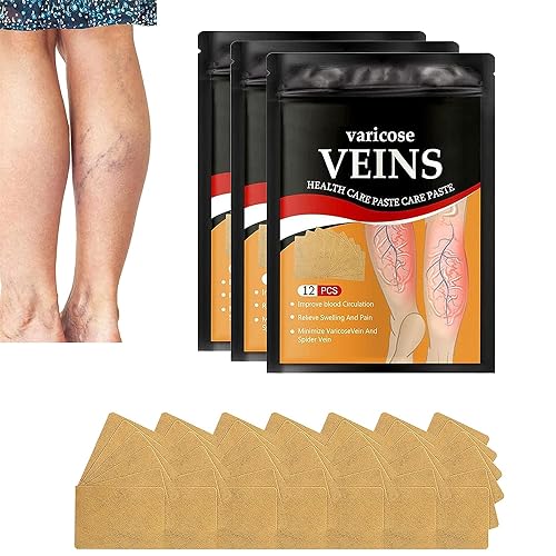 PARCHES PARA VARICES - ¡🌿 Solución natural para tus várices!